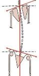 leg length scoliosis